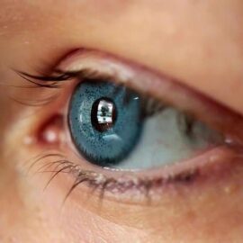 Bright Eyes Iris Color Change Surgery Corpus Christi TX