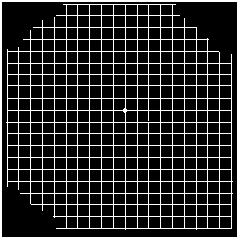 Arcuate scotoma symptoms in an Amsler grid