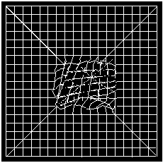 Metamorphopsia symptoms viewed on Amsler Grid