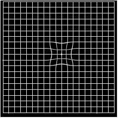 Micropsia symptom viewed on Amsler Grid